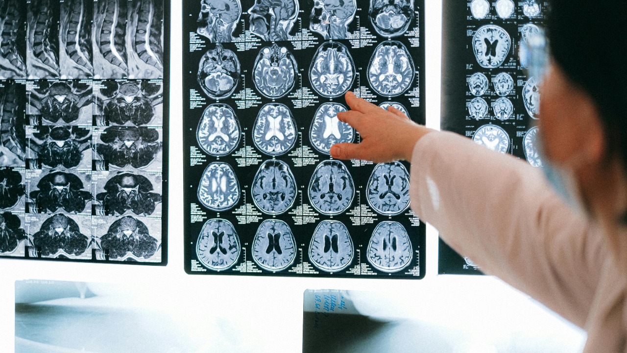 A new brain-imaging study just showed recalling facts and reliving ...