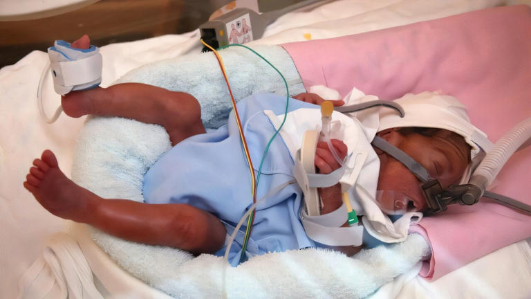 Rewiring early life: What extremely preterm birth teaches us about the ...