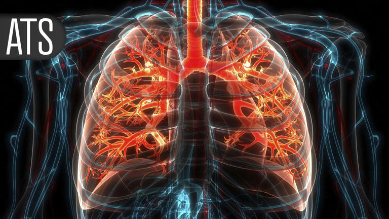 Post-ICU rehab program misses mark for improving quality of life