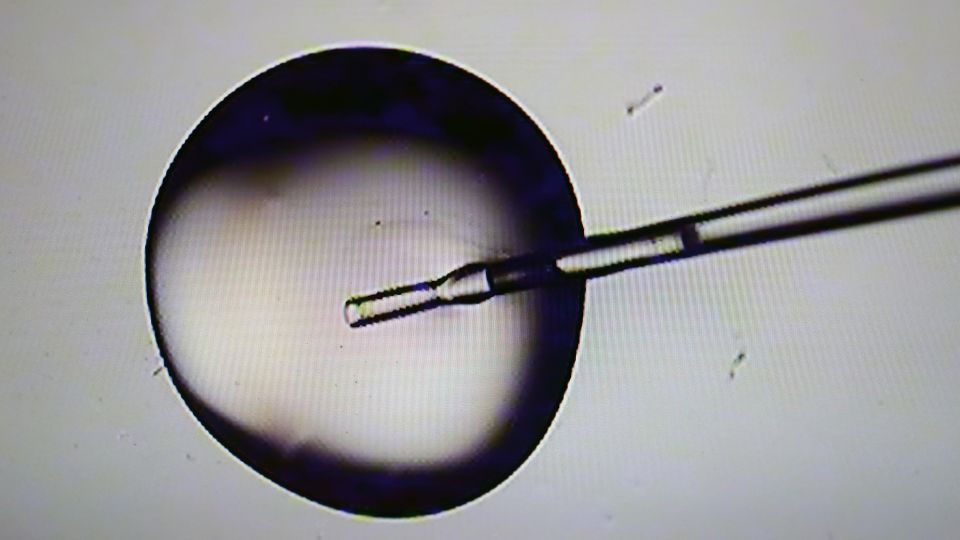 Trump promised no-cost IVF treatment for all. That’s still a long way off