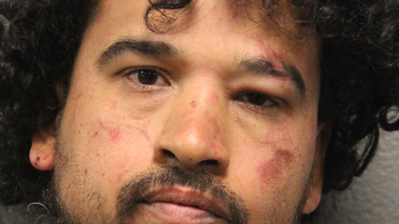 Chicago man charged in shooting during West Side armed robbery, police say