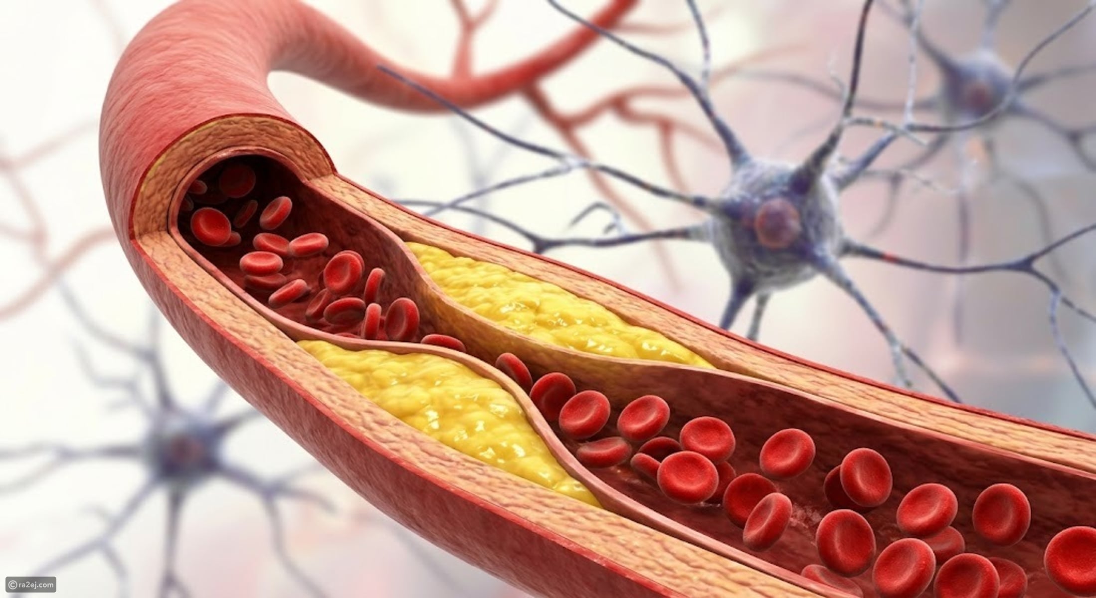 Researchers reveal 2 new dementia risk factors everyone should know