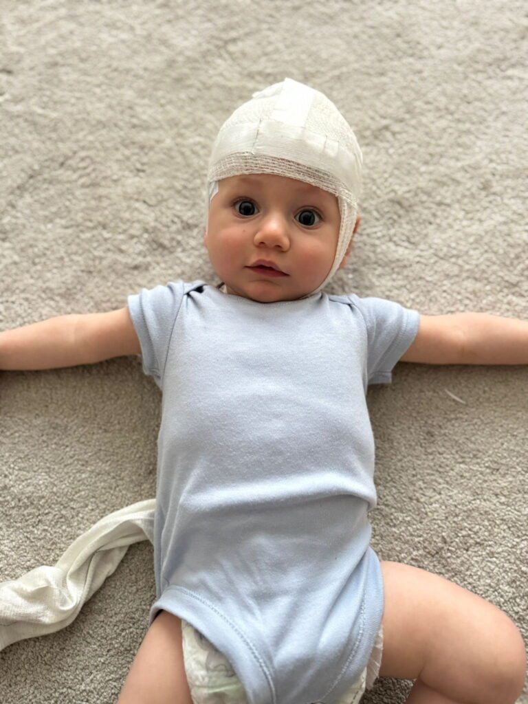 Baby’s eye flicker was sign of one in a million neurological condition