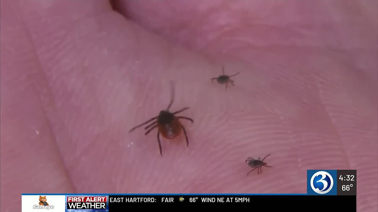 Connecticut sees highest levels of emergency room visits for tick bites ...