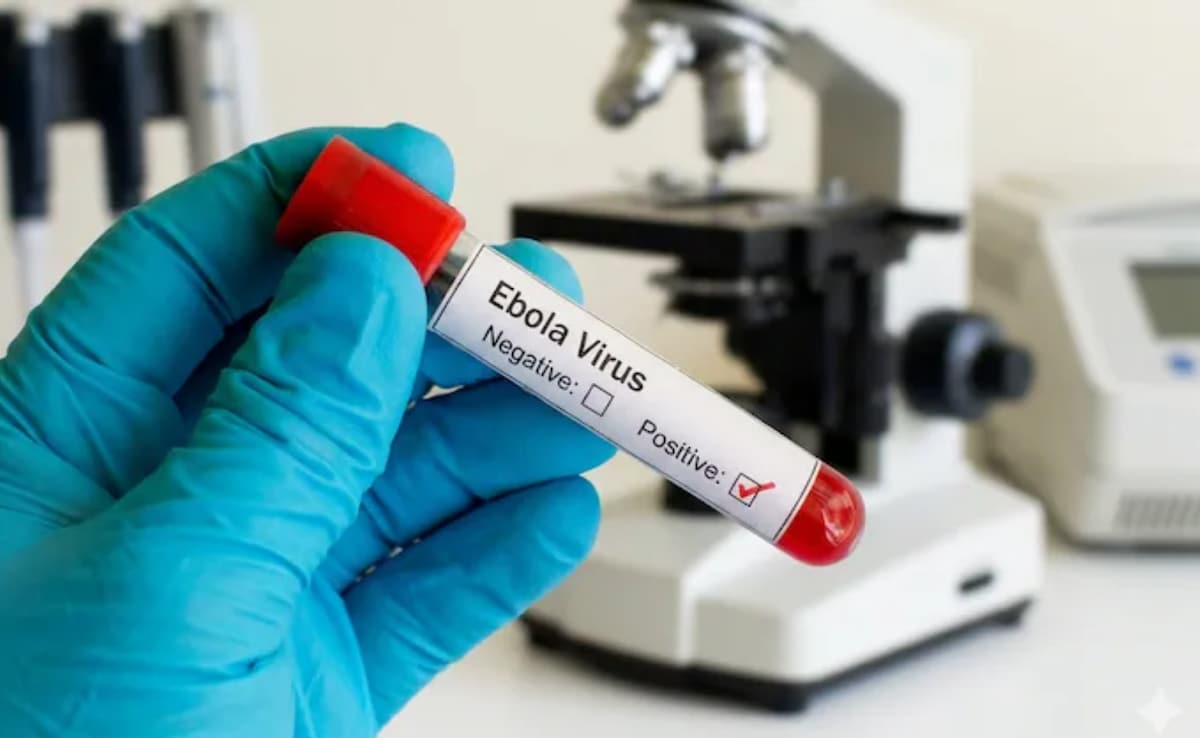 From Ebola to mpox: Why delayed vaccine access remains a major global ...