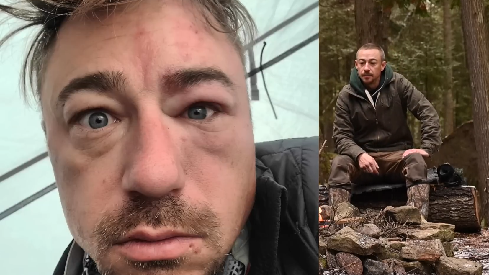 He thought it was bug bites on his face - then doctors found something ...