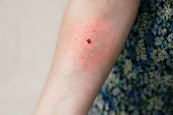 'Call 111' if you spot this shape on your skin as over 1,000 cases of ...