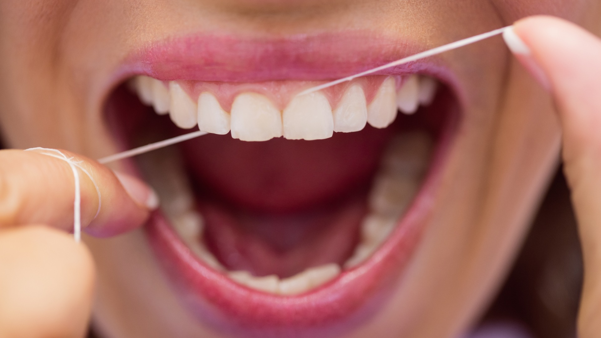 Why do dentists insist so much on using dental floss?