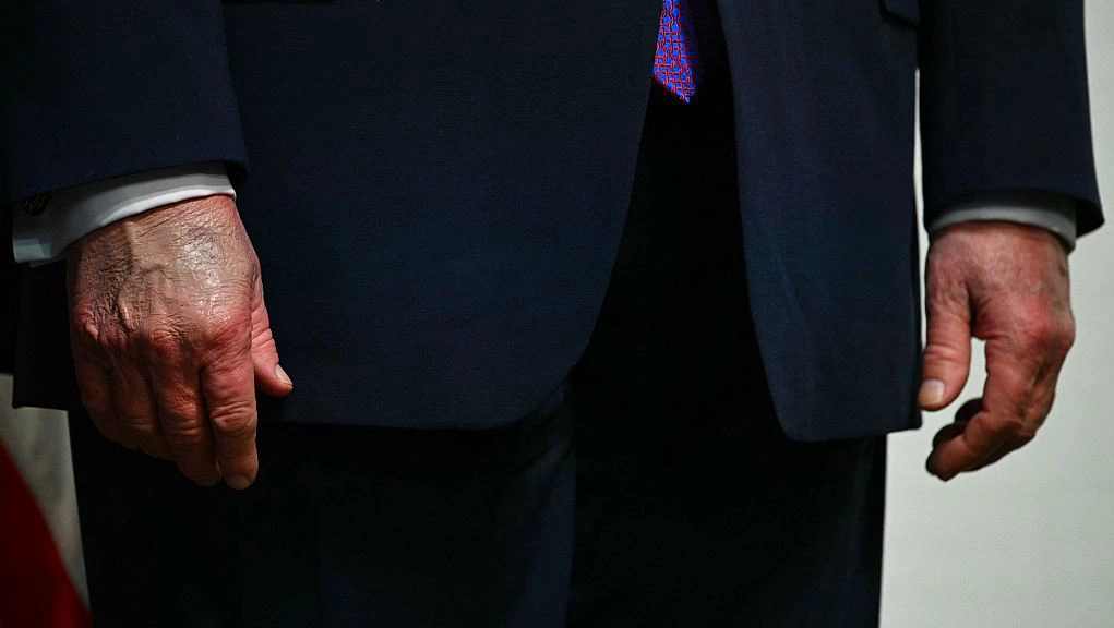 Viral photo of Trump and RFK Jr. hands fuels health debate