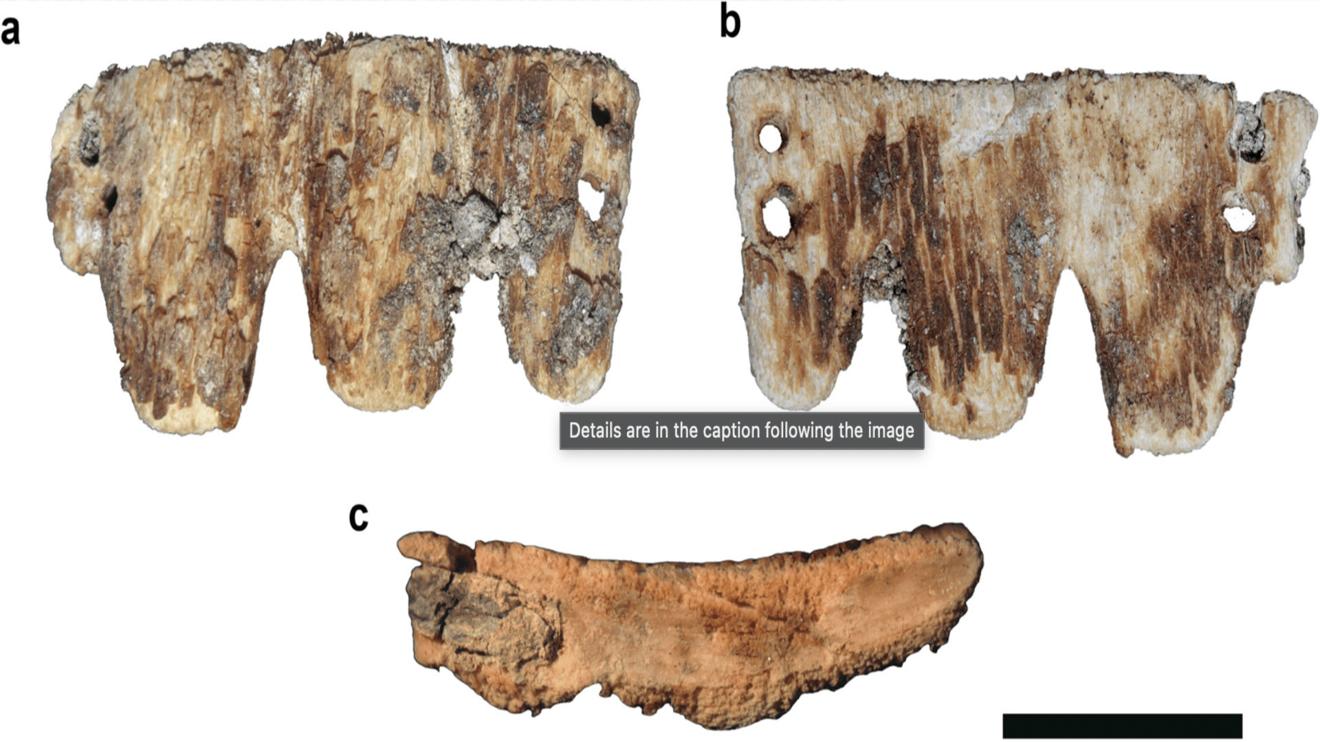 Rare 19th-century dental prosthetic that a wealthy person wore found in ...
