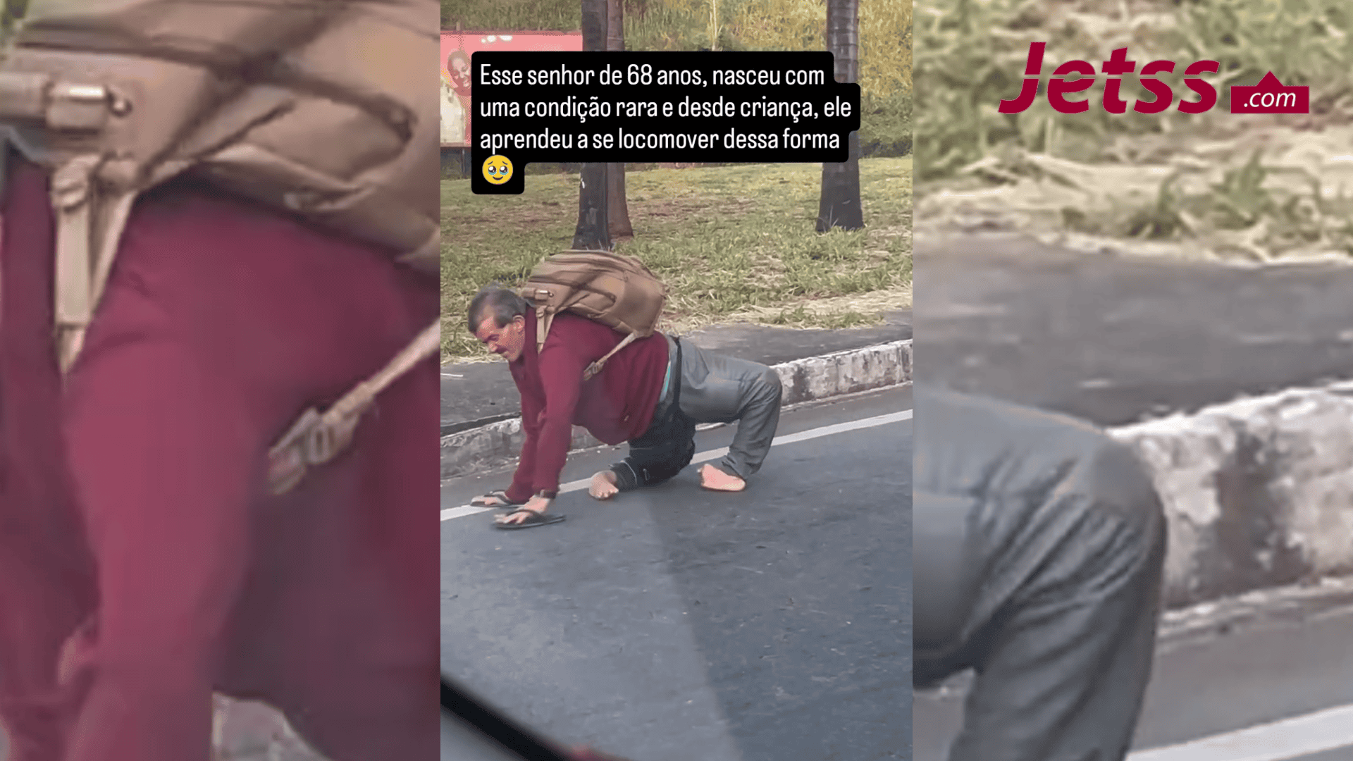 Um senhor de 68 anos nasceu com uma condição rara e, desde criança ...