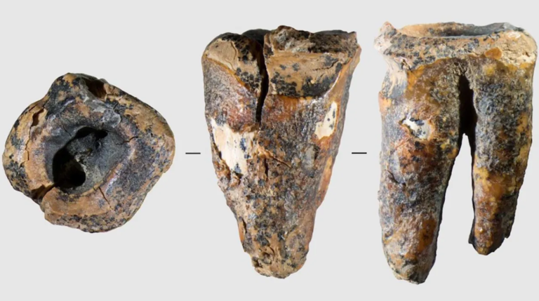 Neanderthal root canal pushes back origins of dentistry