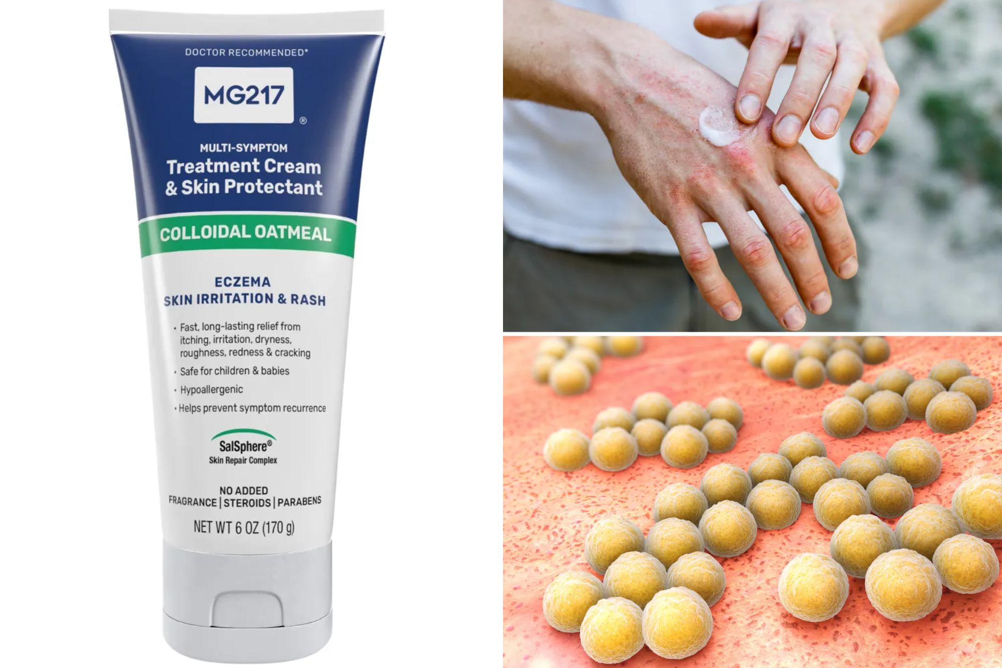 Skin cream sold on Amazon recalled over deadly bacteria risk