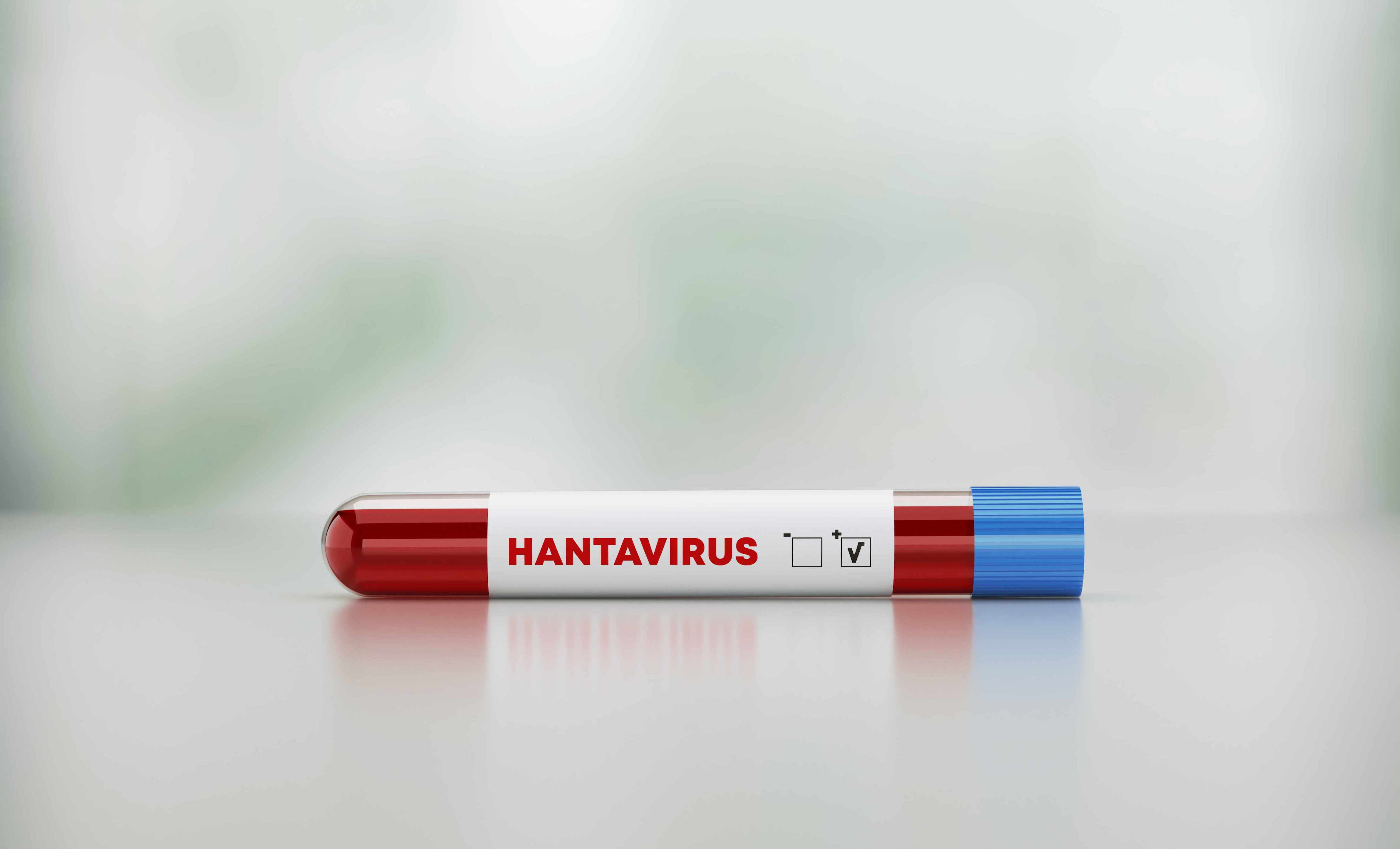 Should parents be worried about hantavirus? What experts say after cruise ship outbreak
