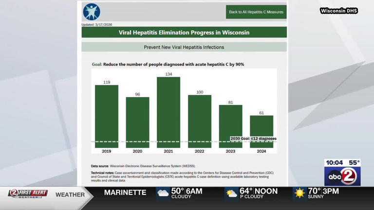 Wisconsin launches plan to eliminate viral hepatitis by 2030