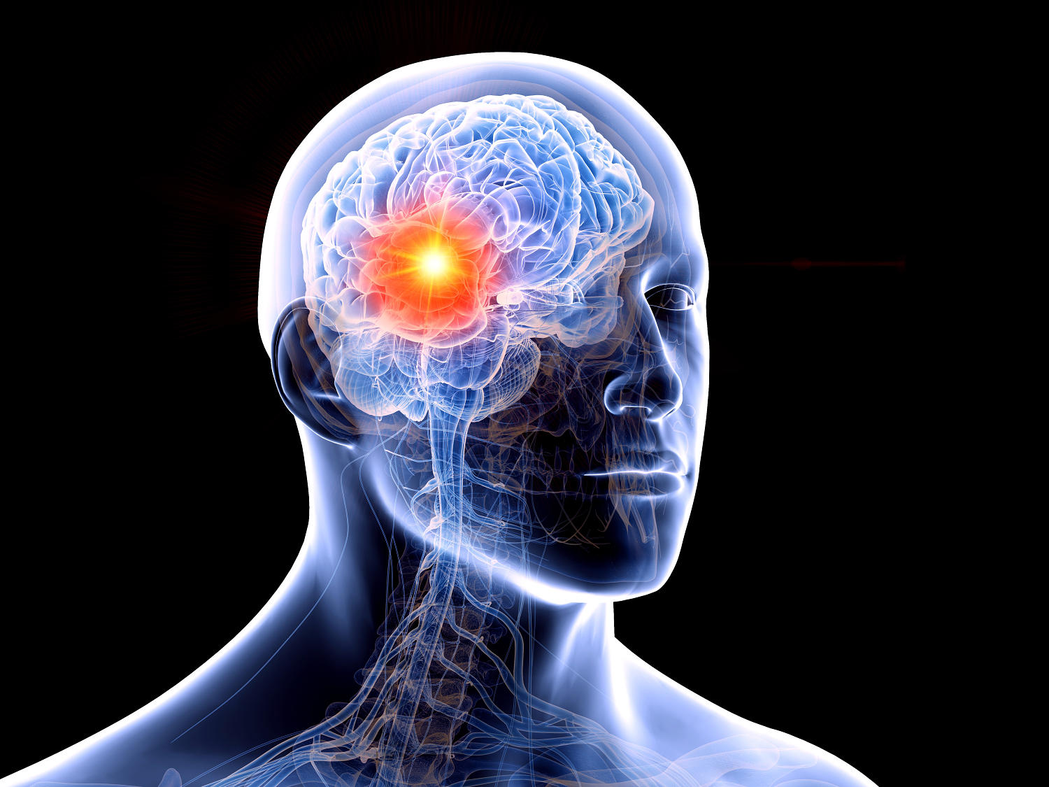 How a doctor monitors herself for brain tumors and the No. 1 most ...