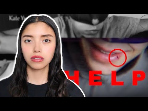La historia de Kate Yup: un caso increíble