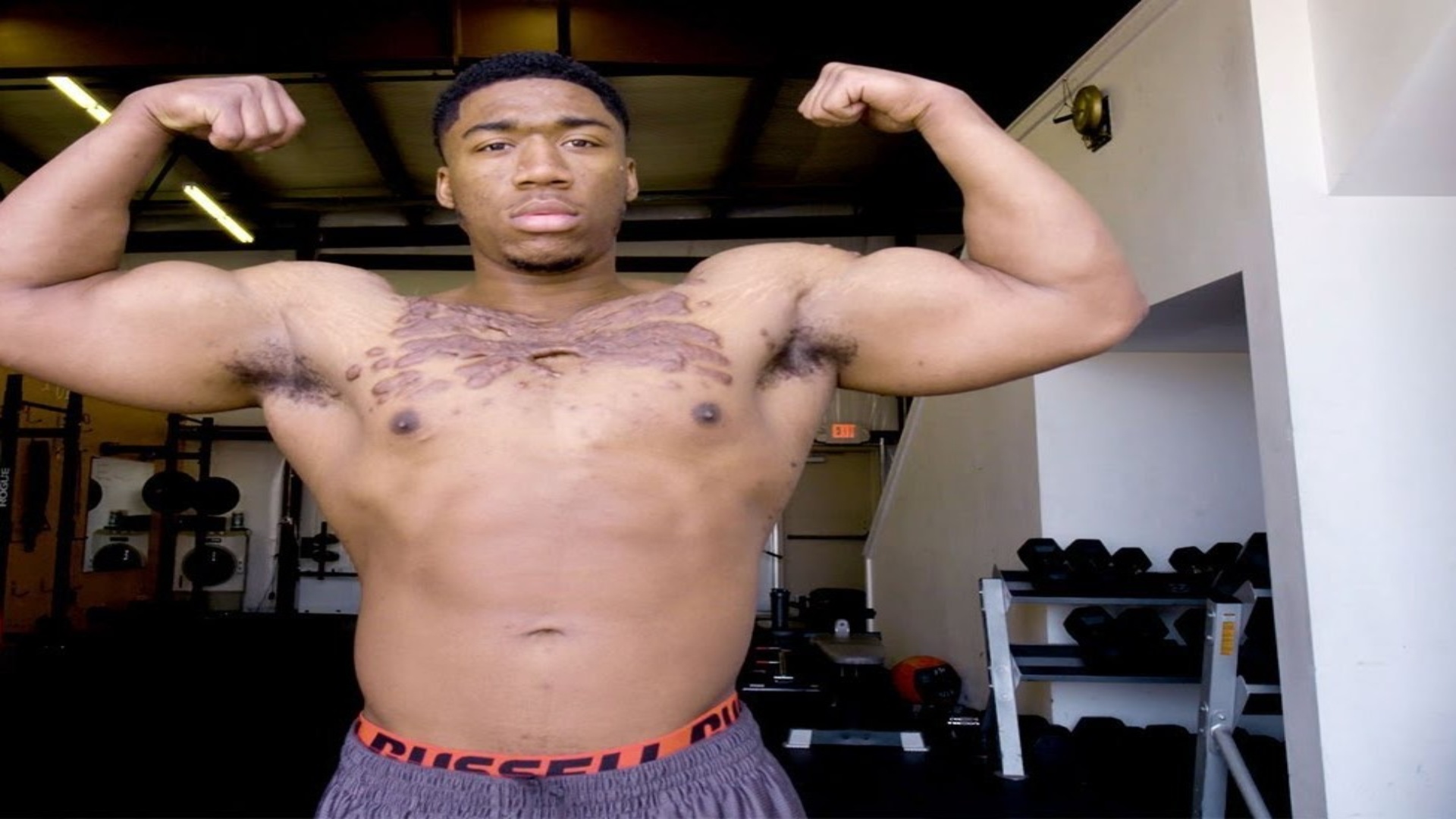 Isaiah Griffin turning scars into strength through bodybuilding
