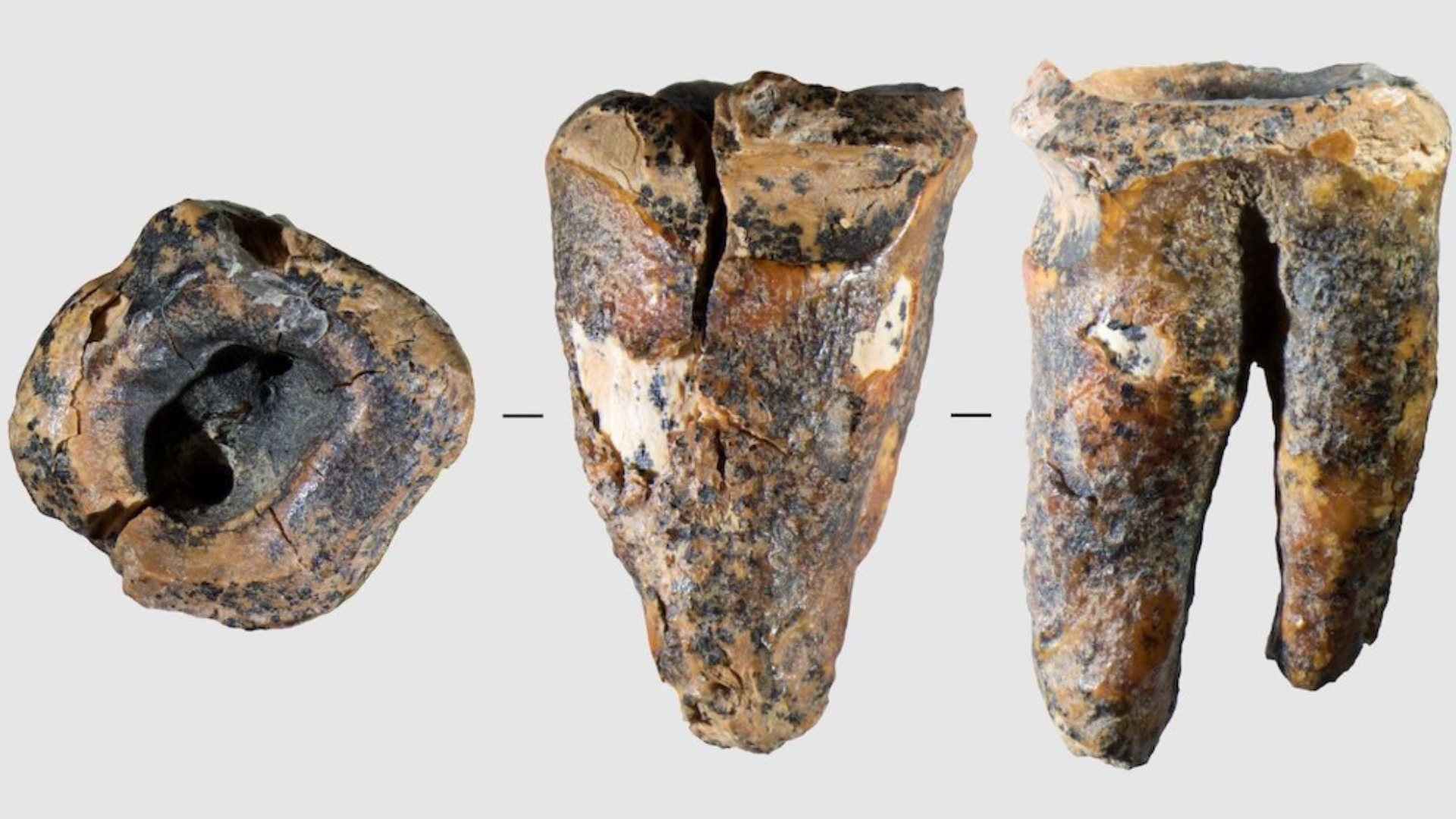 PCOS new name, Neanderthals oldest dentists, and the 'alien' crystal ...