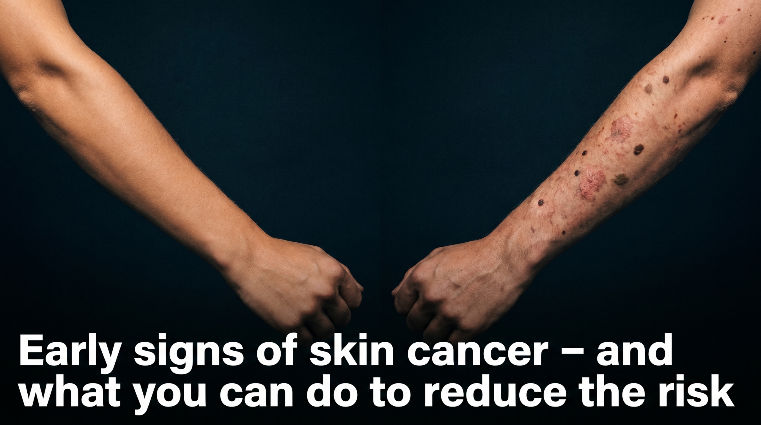 Early signs of skin cancer – and what you can do to reduce the risk