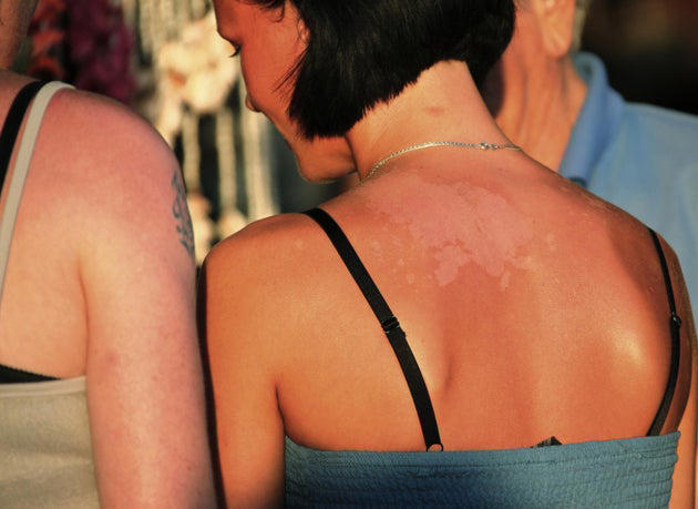 RFK Jr. wants teens to be able to use tanning beds — and the logic ...