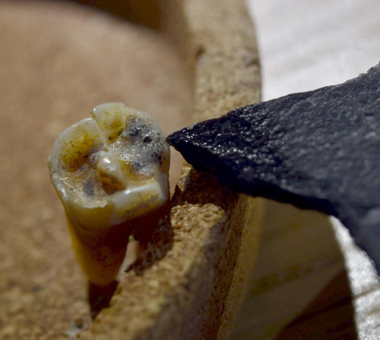 Neanderthals practiced dental care 59,000 years ago