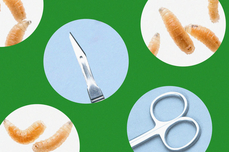 Good news: You don’t need surgery. But you’ll have to apply maggots to ...