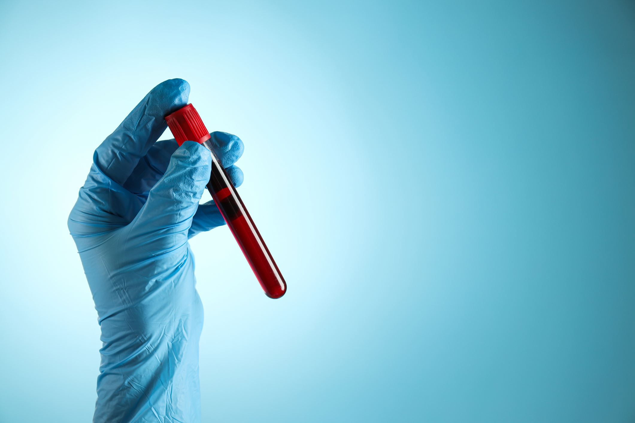 For cancer survivors, this type of test may be key