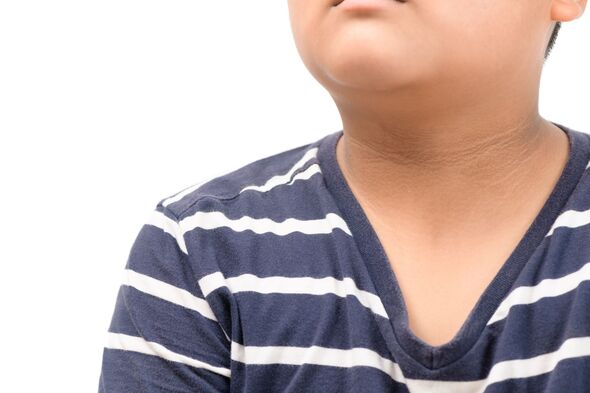Little-known skin change in children could be early sign of diabetes