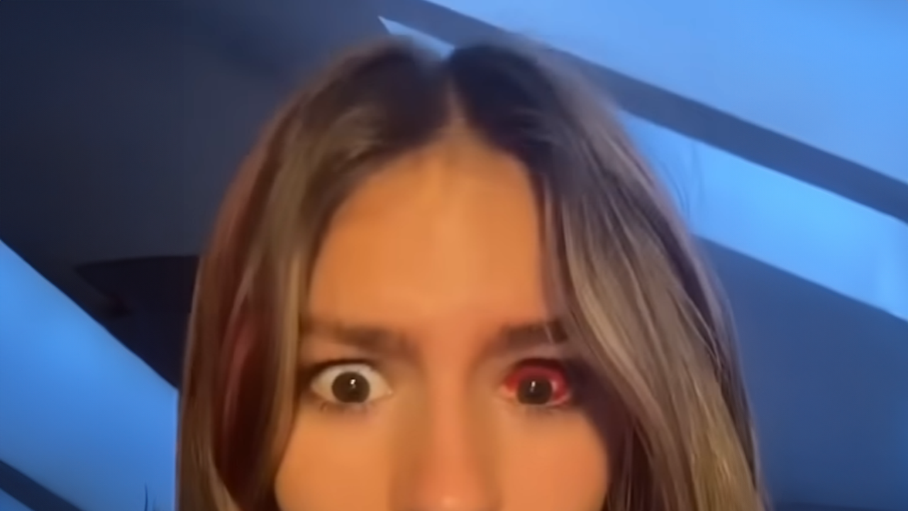 Doctor explains what happened to her eye