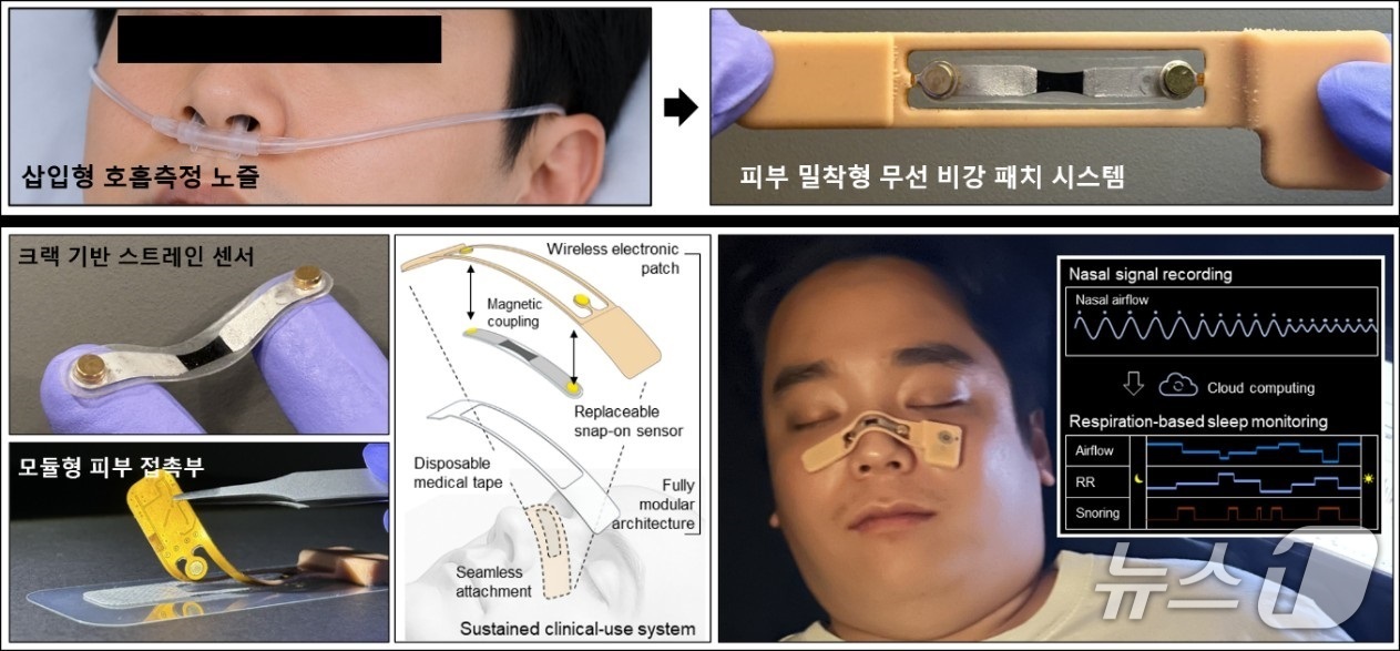 충남대 조성진 교수팀, 비강 패치 기반 무선 호흡 모니터링 시스템 개발