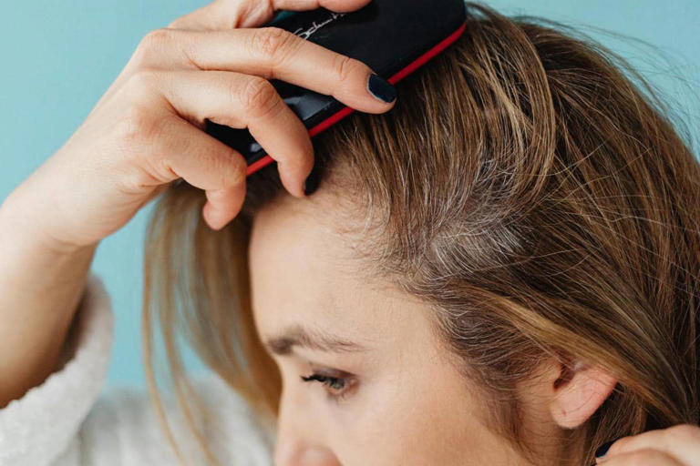Apakah minyak zaitun bisa menumbuhkan rambut? Cek faktanya