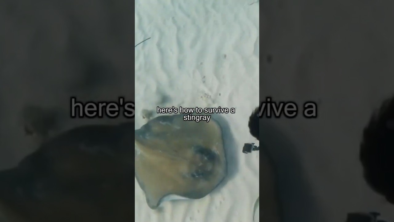 Learn the first aid steps to survive a painful stingray injury
