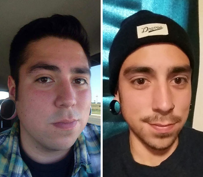 98 Before-And-After Pics Show What Happens When You Stop Drinking