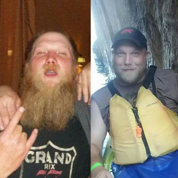 98 Before-And-After Pics Show What Happens When You Stop Drinking