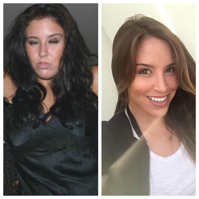98 Before-And-After Pics Show What Happens When You Stop Drinking