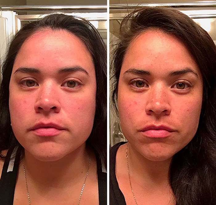 98 Before-And-After Pics Show What Happens When You Stop Drinking
