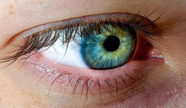 5 silent eye warning signs you should never ignore