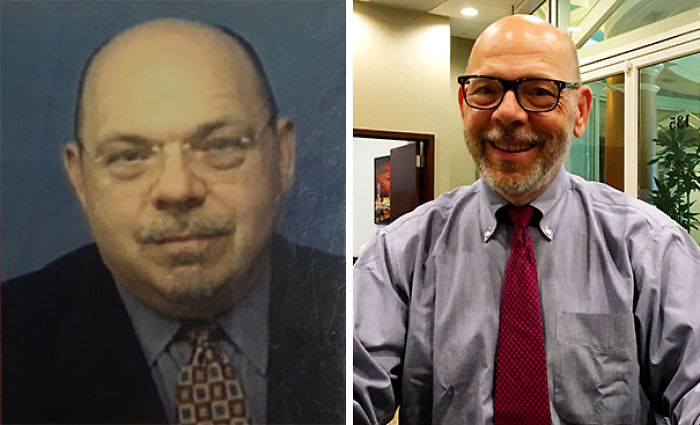 98 Before-And-After Pics Show What Happens When You Stop Drinking