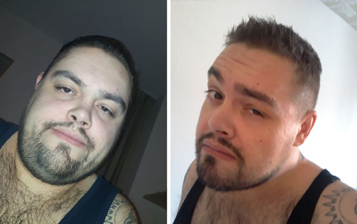 98 Before-And-After Pics Show What Happens When You Stop Drinking