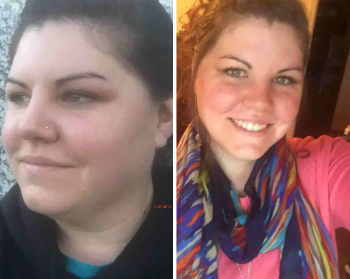 98 Before-And-After Pics Show What Happens When You Stop Drinking