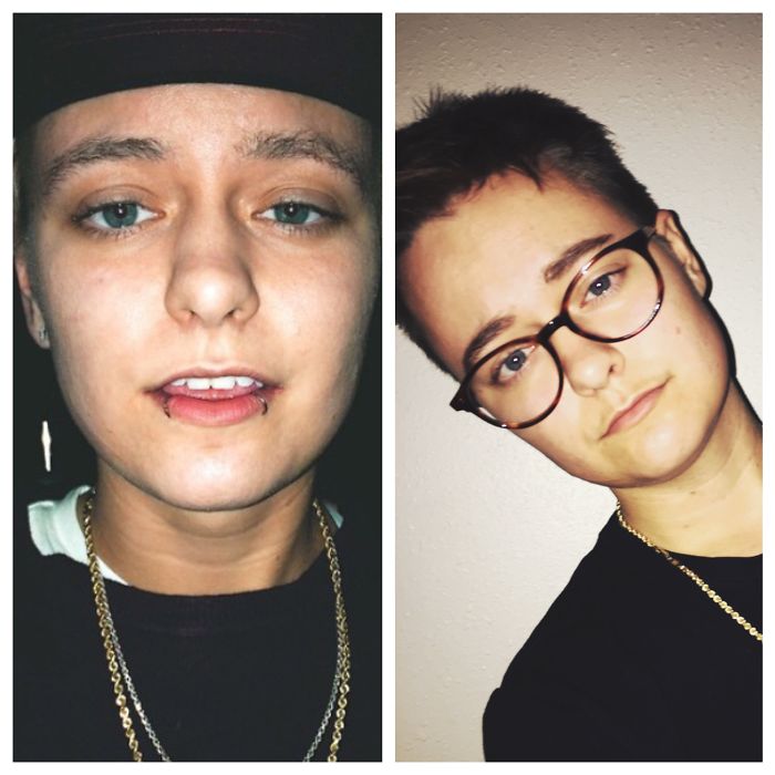 98 Before-And-After Pics Show What Happens When You Stop Drinking