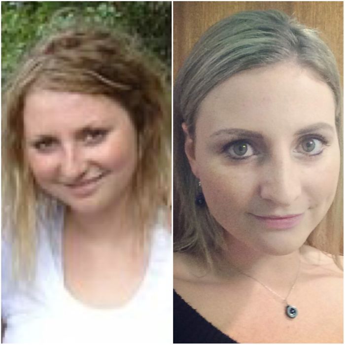 98 Before-And-After Pics Show What Happens When You Stop Drinking