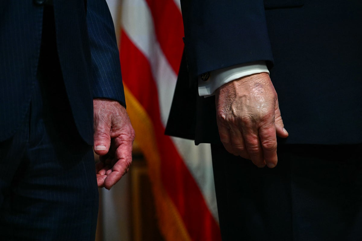 RFK Jr debuts his own hand bruise to match Trump’s