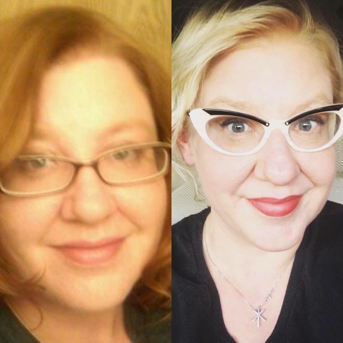 98 Before-And-After Pics Show What Happens When You Stop Drinking