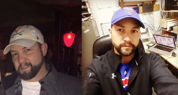 98 Before-And-After Pics Show What Happens When You Stop Drinking