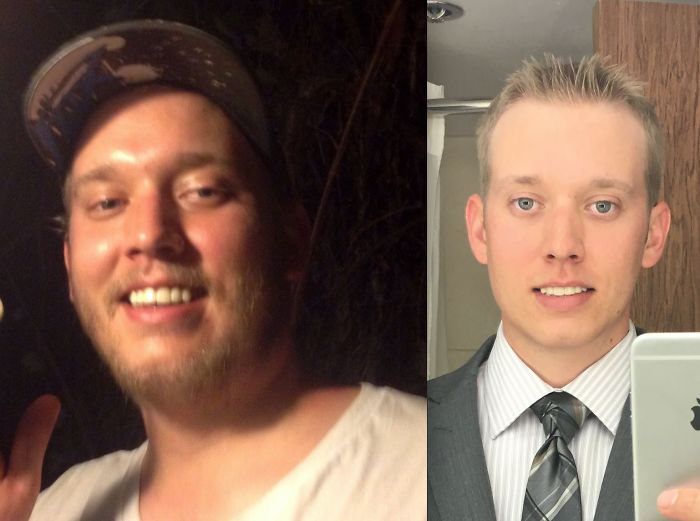 98 Before-And-After Pics Show What Happens When You Stop Drinking