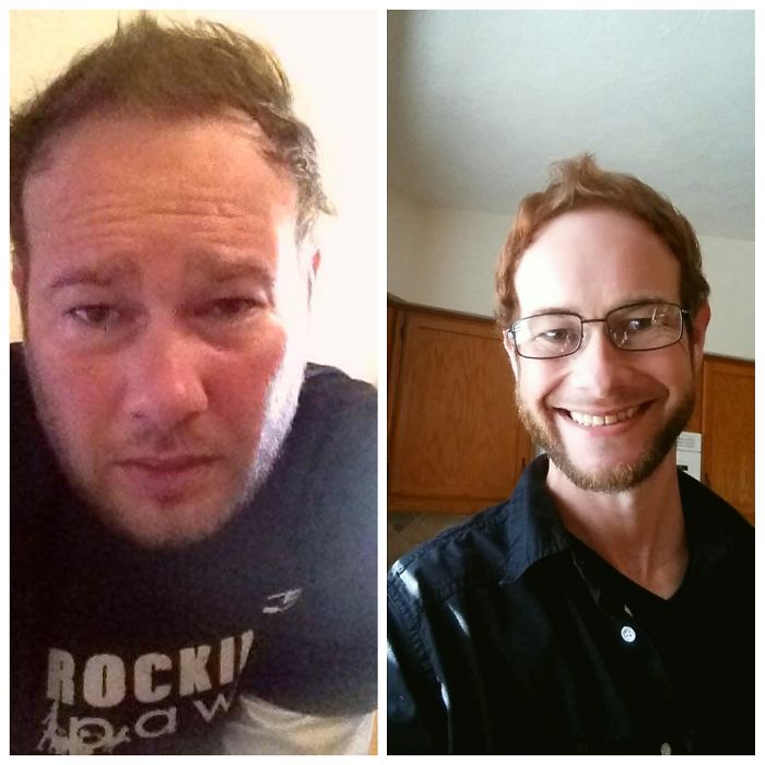 98 Before-And-After Pics Show What Happens When You Stop Drinking