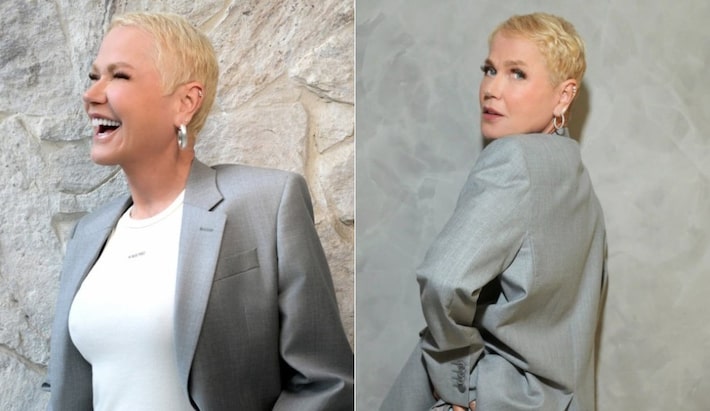 Xuxa antes e depois do procedimento Foto: @xuxameneghel via Instagram