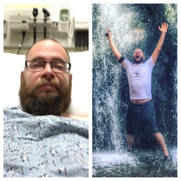 98 Before-And-After Pics Show What Happens When You Stop Drinking